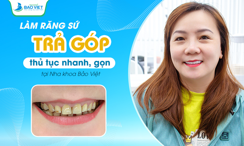 Làm răng sứ trả góp tại nha khoa Bảo Việt