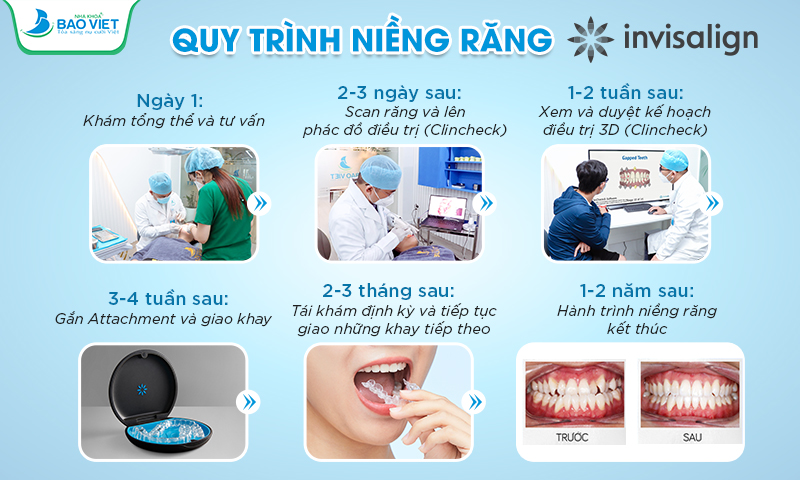 Quy trình niềng răng trong suốt Invisalign tại Nha khoa Bảo Việt